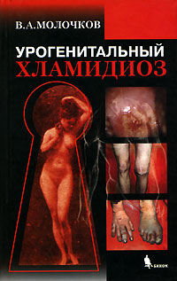 Урогенитальный хламидиоз