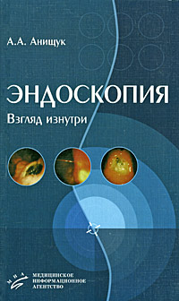 Эндоскопия. Взгляд изнутри