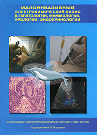 Малоинвазивный электрохимический лизис в гепатологии, маммологии, урологии, эндокринологии