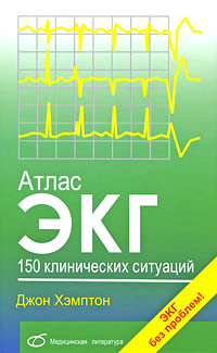 Атлас ЭКГ. 150 клинических ситуаций