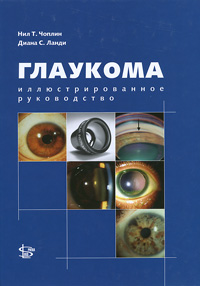 Глаукома. Иллюстрированное руководство