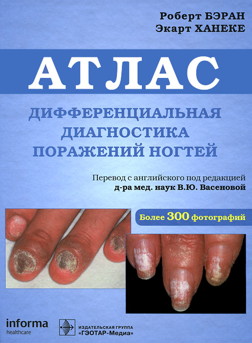 Дифференциальная диагностика поражения ногтей. Атлас