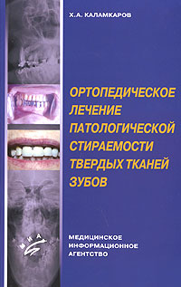 Ортопедическое лечение патологической стираемости твердых тканей зубов