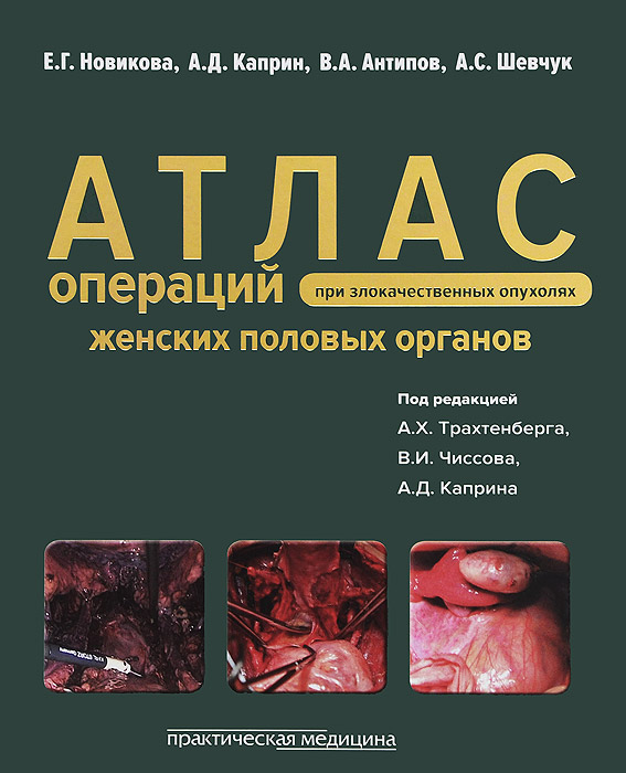 Атлас операций при злокачественных опухолях женских половых органов