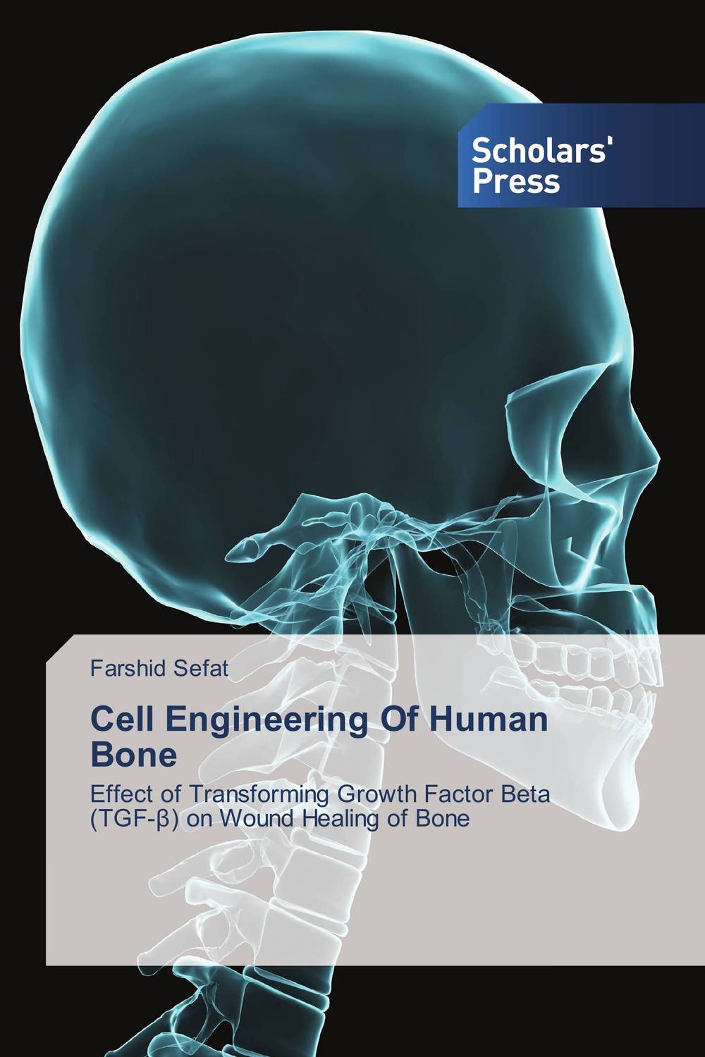 Cell Engineering Of Human Bone12296407 Cell Engineering Of Human Bone12296407Bone repair is modulated by different stimuli. There is evidence that the Transforming Growth Factor-beta (TGF-?) super-family of cytokines have significant effects on bone structure by regulating the replication and differentiation of chondrocytes, osteoblasts and osteoclasts. This book aimed at determining the role of the TGF-?s, Collagen type I, Fibronectin and Laminin in bone cell behaviour. To do this MG-63 bone cells were used to examine cell adhesion and alignment to different micro-contact printed ECM protein patterns of different widths. The study also aimed at examining how various TGF-? isomers (TGF-?1, 2 and 3) and their solvent and carrier (HCl and BSA, respectively) effected cell surface interactions, cell morphology, cell proliferation and integrin expression. Finally, this study also aimed at examining how the TGF-?s and their solvent and carrier influenced wound closure in an in vitro wound closure model and how TGF-?s influence ECM secretion and integrin expression.