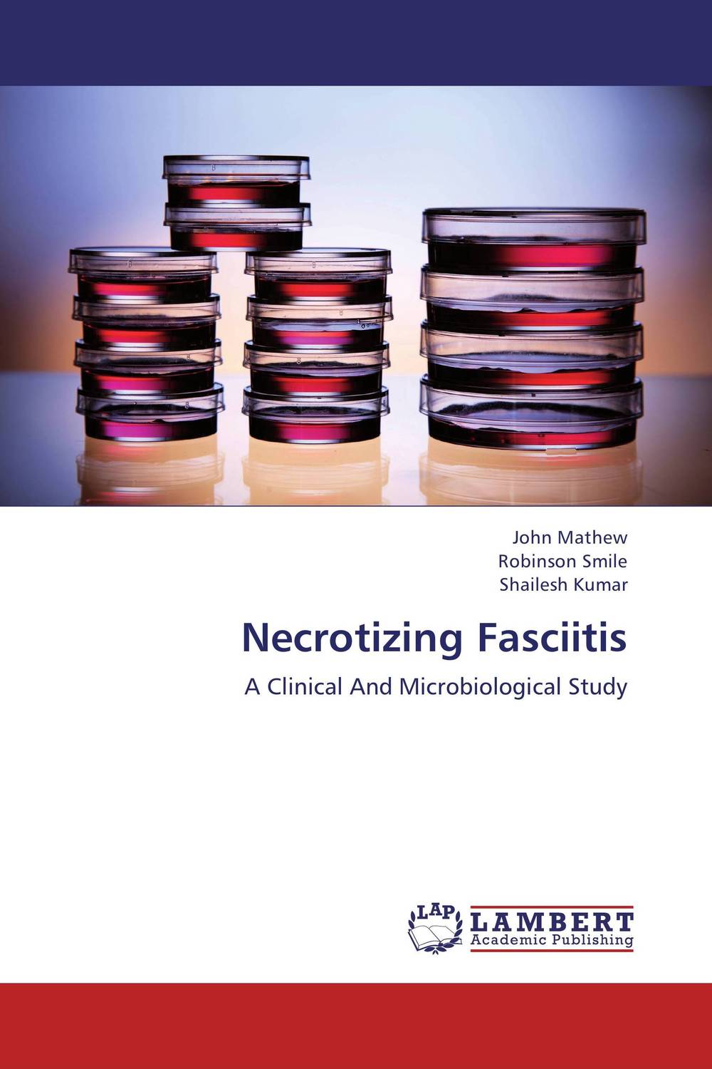 Necrotizing Fasciitis12296407 Necrotizing Fasciitis12296407Necrotizing fasciitis is a progressive, rapidly spreading, inflammatory infection located in deep fascia. It may cause necrosis of skin and subcutaneous tissues. Spreading of it may lead to shock, organ failure and even death. In this study, we evaluated prevalence of variables including age, sex, predisposing factors, co morbid conditions, clinical and microbiological findings, distribution of tissue involvement, treatment, outcome and mortality rate in 60 patients of necrotizing fasciitis. The study was a descriptive study which involved a single group of patients with Necrotizing Fasciitis admitted in Mahatma Gandhi Medical College & Research Institute, Pondicherry, India, between the period of 2009 September and 2011 August.