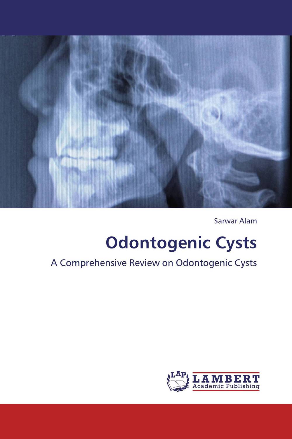 Odontogenic Cysts