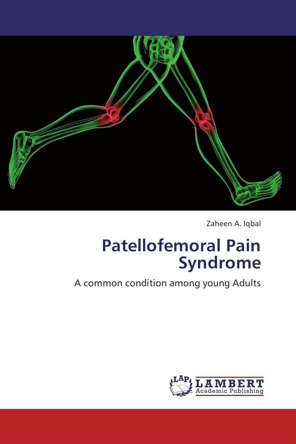 Patellofemoral Pain Syndrome