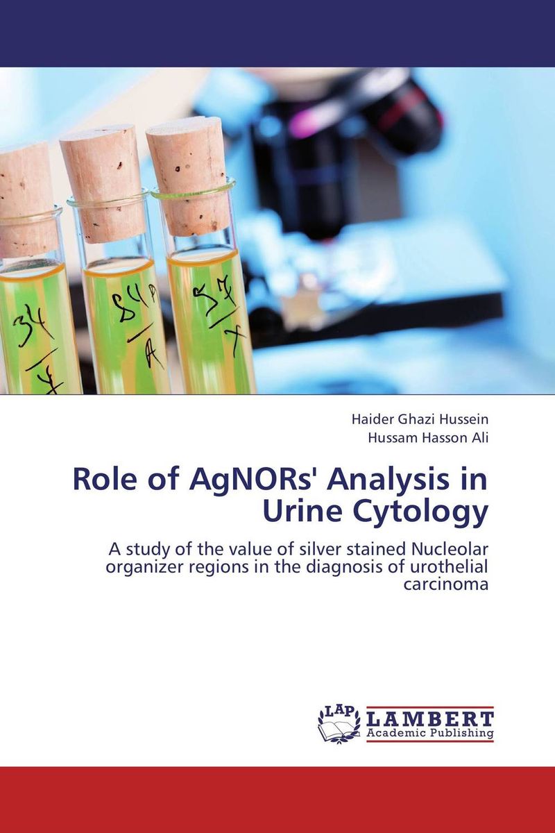 Role of AgNORs` Analysis in Urine Cytology