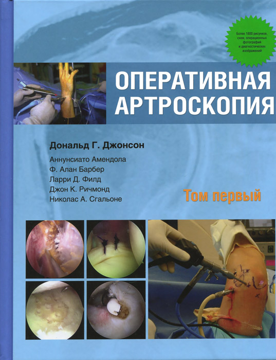 Оперативная артроскопия. В 2 томах. Том 1