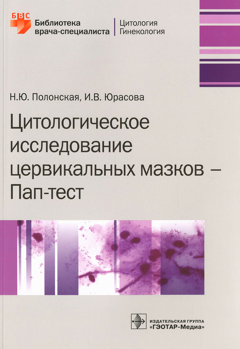 Цитологическое исследование цервикальных мазков - Пап-тест