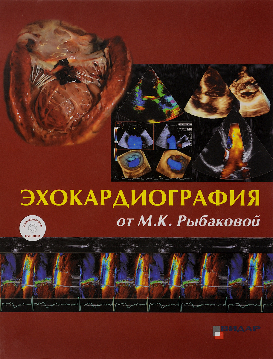 Эхокардиография от М. К. Рыбаковой. Учебник (+ DVD)