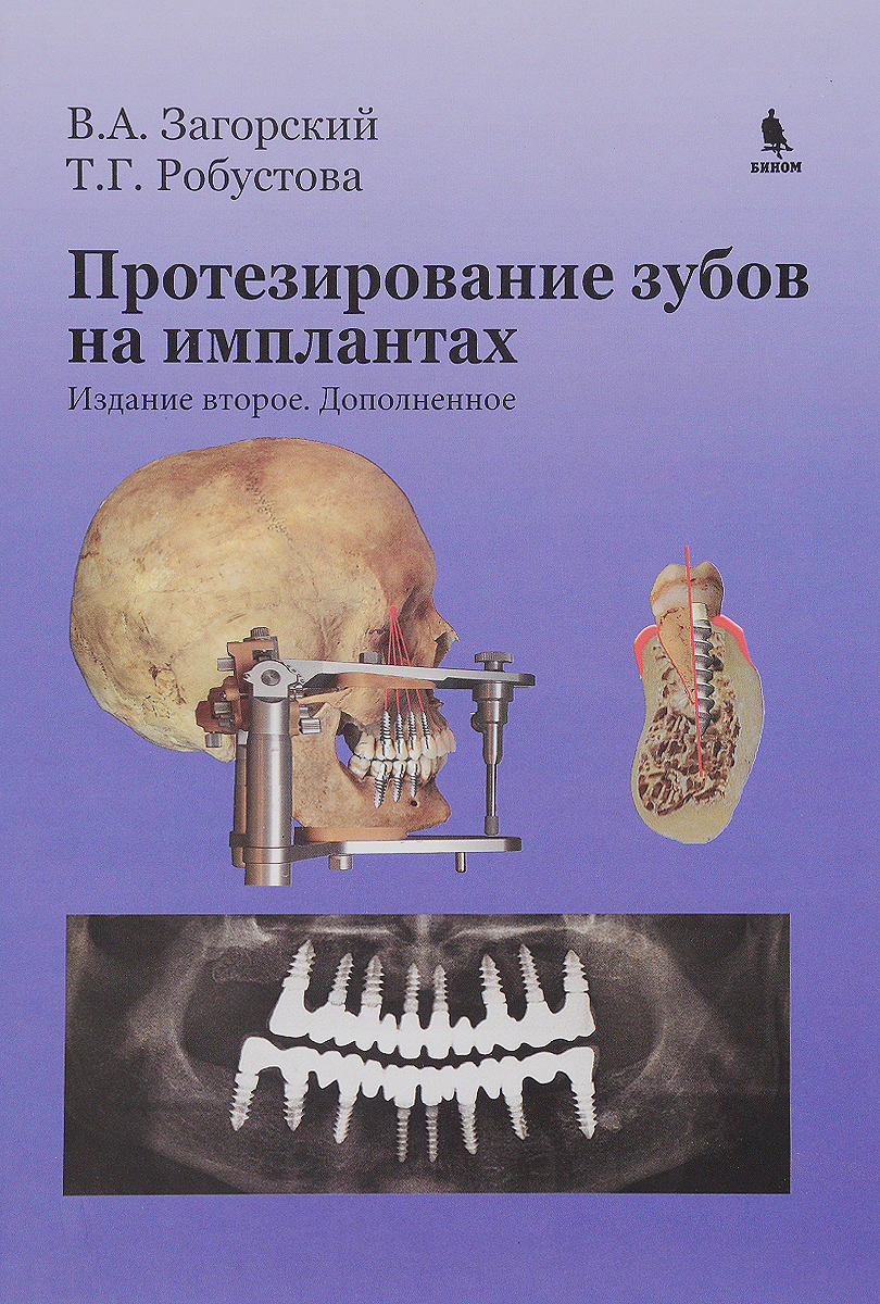 Протезирование зубов наимплантантах. изд. 2-е