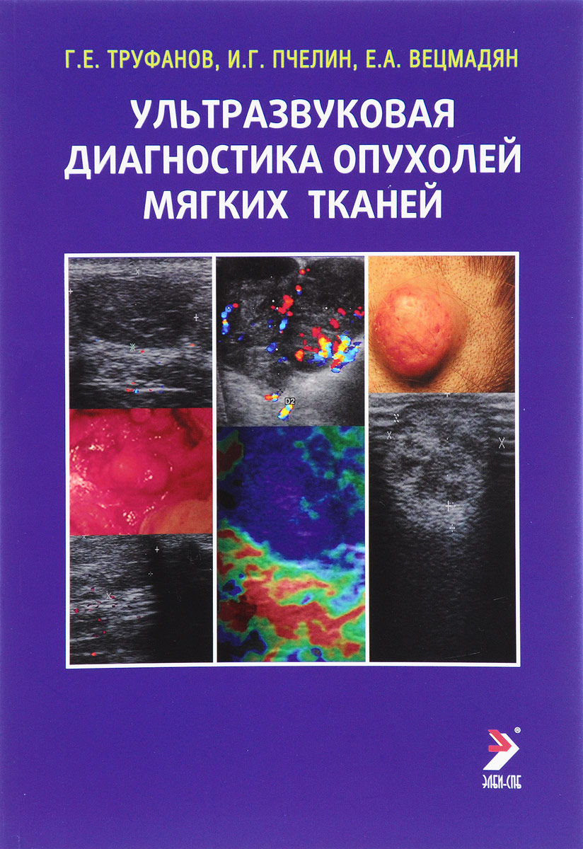 Ультразвуковая диагностика опухолей мягких тканей