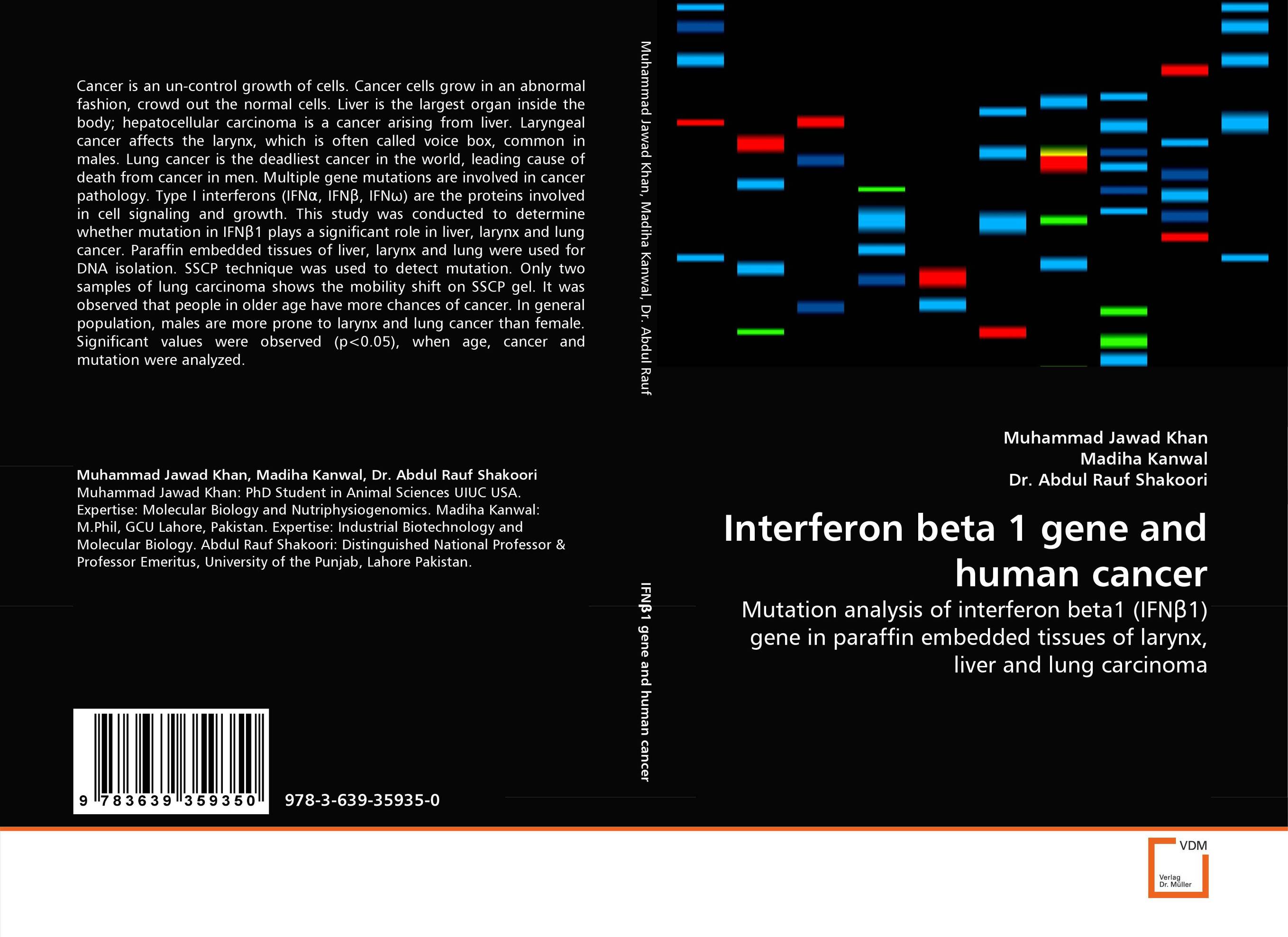 Interferon beta 1 gene and human cancer