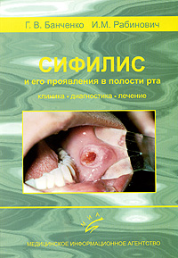 Сифилис и его проявления в полости рта. Клиника, диагностика, лечение