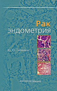 Рак эндометрия. Ю. Ю. Табакман