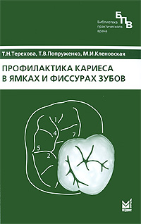 Профилактика кариеса в ямках и фиссурах зубов. Т. Н. Терехова, Т. В. Попруженко, М. И. Кленовская