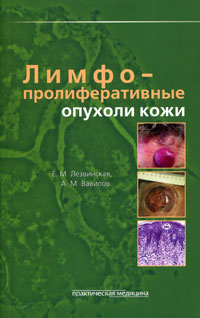 Лимфопролиферативные опухоли кожи. Е. М. Лезвинская, А. М. Вавилов
