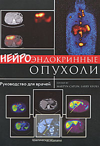Нейроэндокринные опухоли. Руководство для врачей. М. Кэплина, Л. Кволса