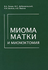 Миома матки и миомэктомия