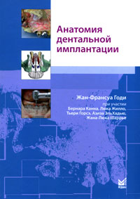 Анатомия дентальной имплантации. Жан-Франсуа Годи, Бернар Канн, Люк Жилло, Тьери Горсэ, Азиз ЭльХадью, Жан-Люк Шаррье