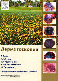 Дерматоскопия. Р. Джор, X. П. Сойер, Дж. Ардженциано, Р. Хофман-Велленхоф, М. Скальвенци