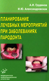 Планирование лечебных мероприятий при заболеваниях пародонта. А. И. Грудянов, И. Ю. Александровская