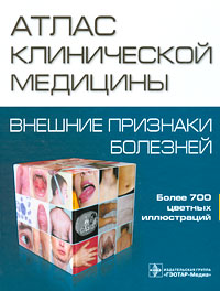 Атлас клинической медицины. Внешние признаки болезней. А. Ф. Томилов