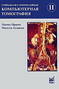 Спиральная и многослойная компьютерная томография. В 2 тах. Том 2. Матиас Прокоп, Михаэль Галански Спиральная и многослойная компьютерная томография. В 2 тах. Том 2. Матиас Прокоп, Михаэль Галански