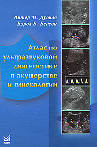 Атлас по ультразвуковой диагностике в акушерстве и гинекологии. Питер М. Дубиле, Кэрол Б. Бенсон