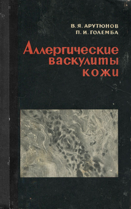 Аллергические васкулиты кожи