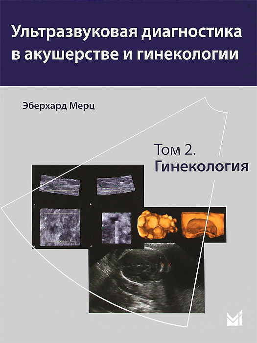Ультразвуковая диагностика в акушерстве и гинекологии. В 2 томах. Том 2. Гинекология. Эберхард Мерц
