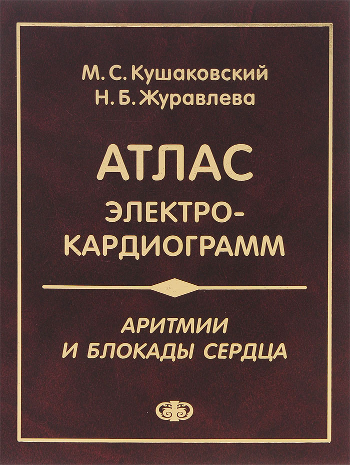 Аритмии и блокады сердца. Атлас электрокардиограмм