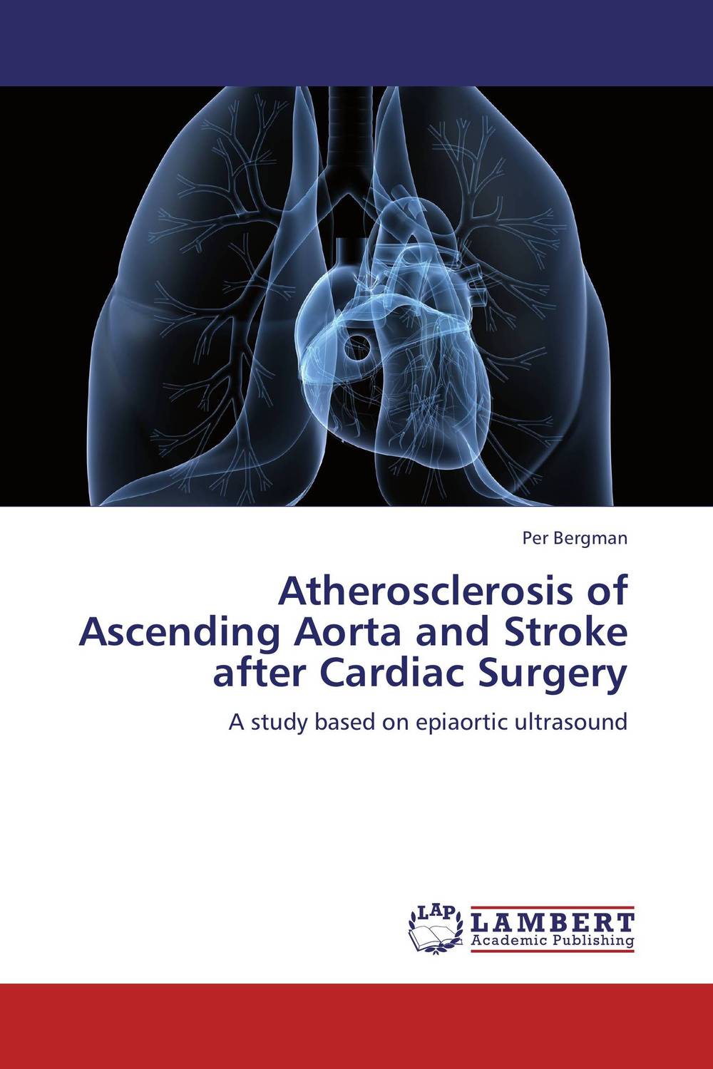 Atherosclerosis of Ascending Aorta and Stroke after Cardiac Surgery