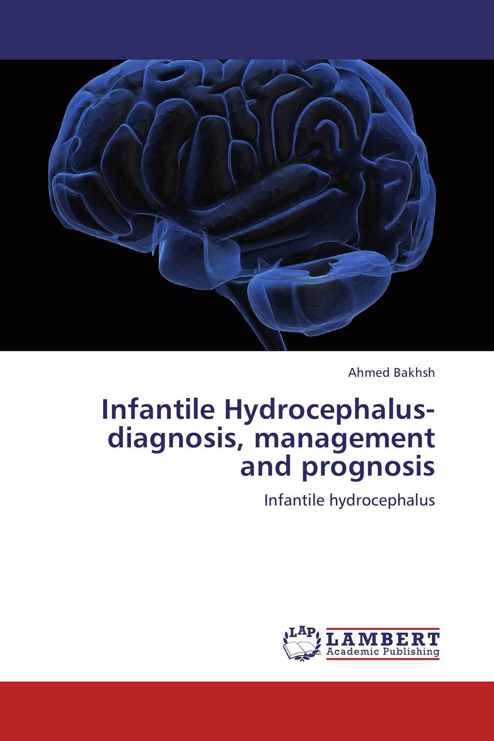 Infantile Hydrocephalus-diagnosis, management and prognosis12296407 Infantile Hydrocephalus-diagnosis, management and prognosis12296407This thesis has been written to stimulate and promote the research in the field of hydrocephalus. This monograph contains basic and clinical aspects of infantile hydrocephalus. It will provide foundation for those who are dedicated to provide an ideal care to infants suffering from hydrocephalus. Still there are few unanswered questions in this subject, which should be further explored by more research work.