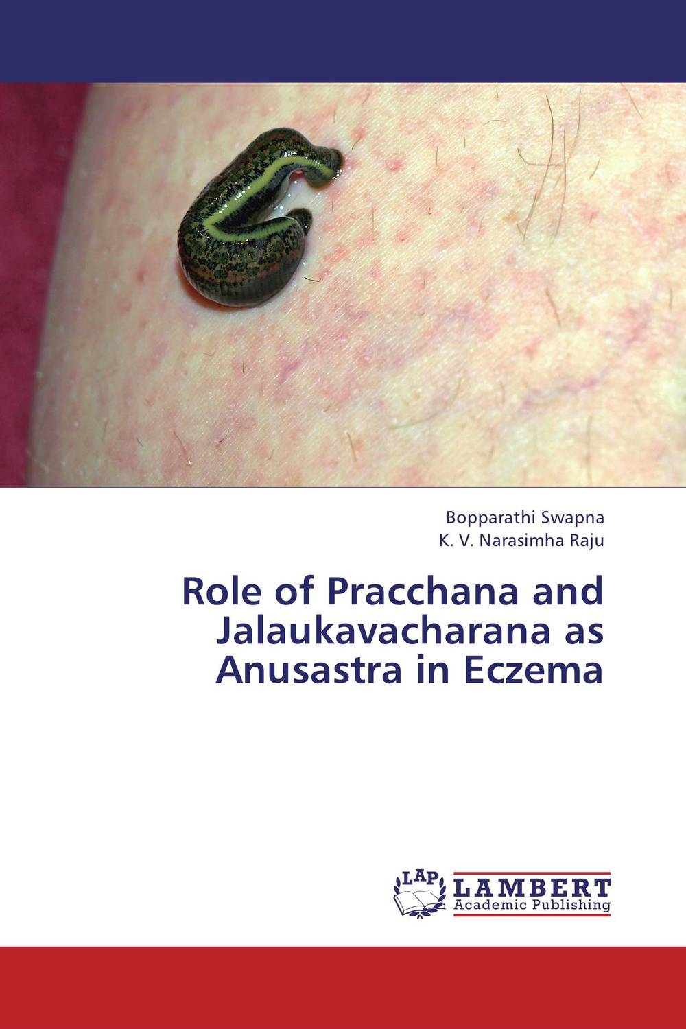 Role of Pracchana and Jalaukavacharana as Anusastra in Eczema