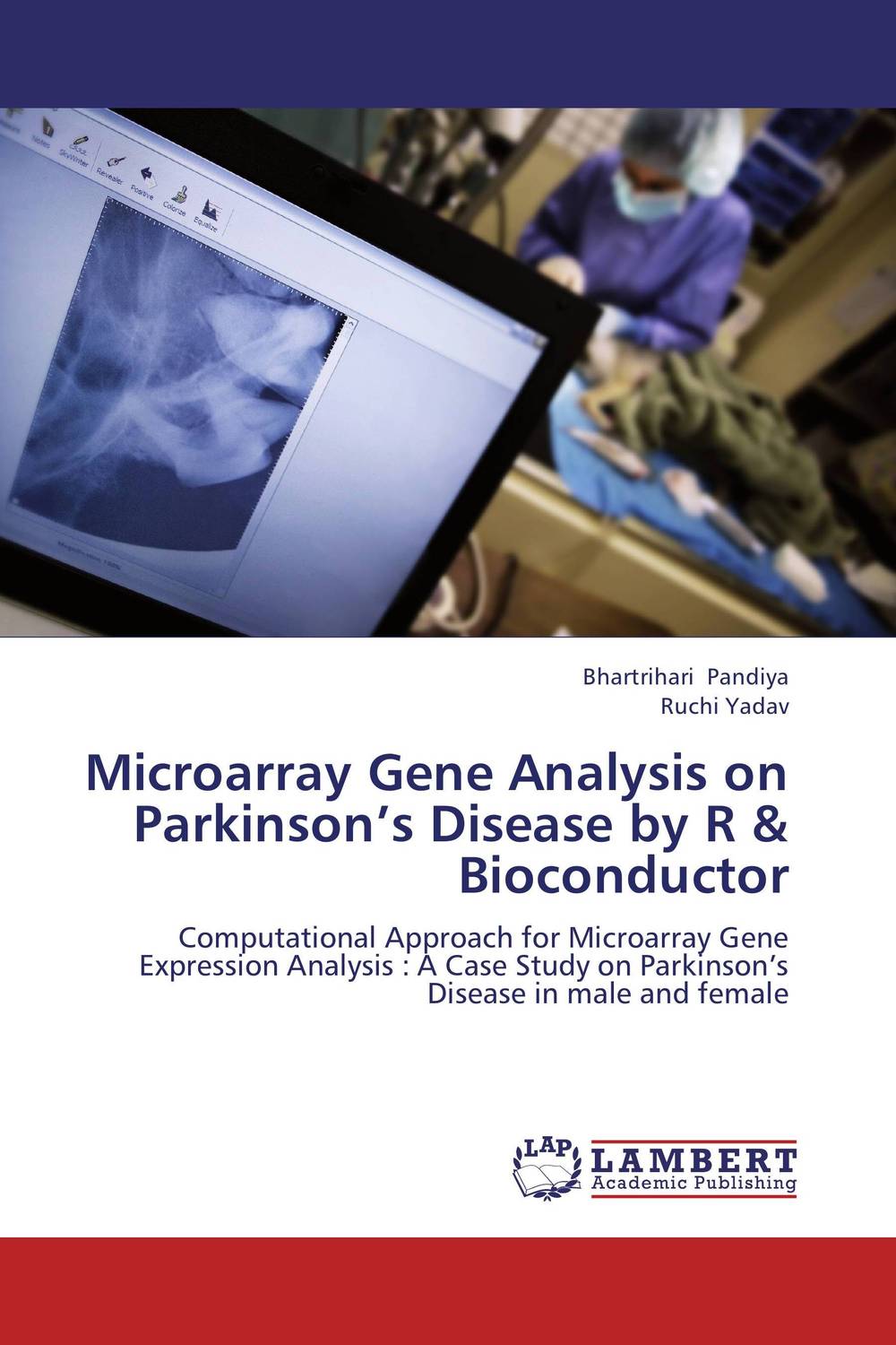 Microarray Gene Analysis on Parkinson’s Disease by R & Bioconductor