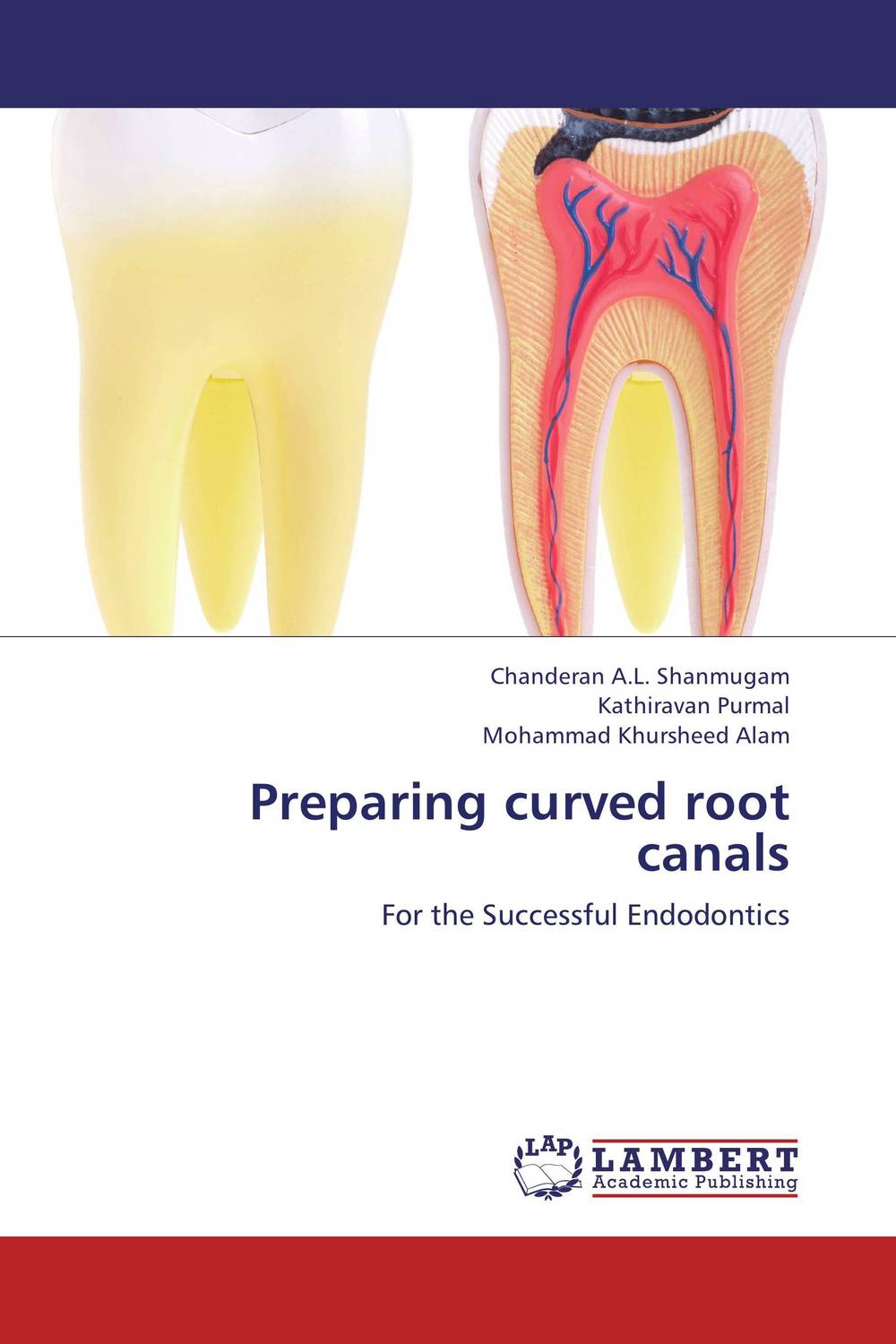 Preparing curved root canals