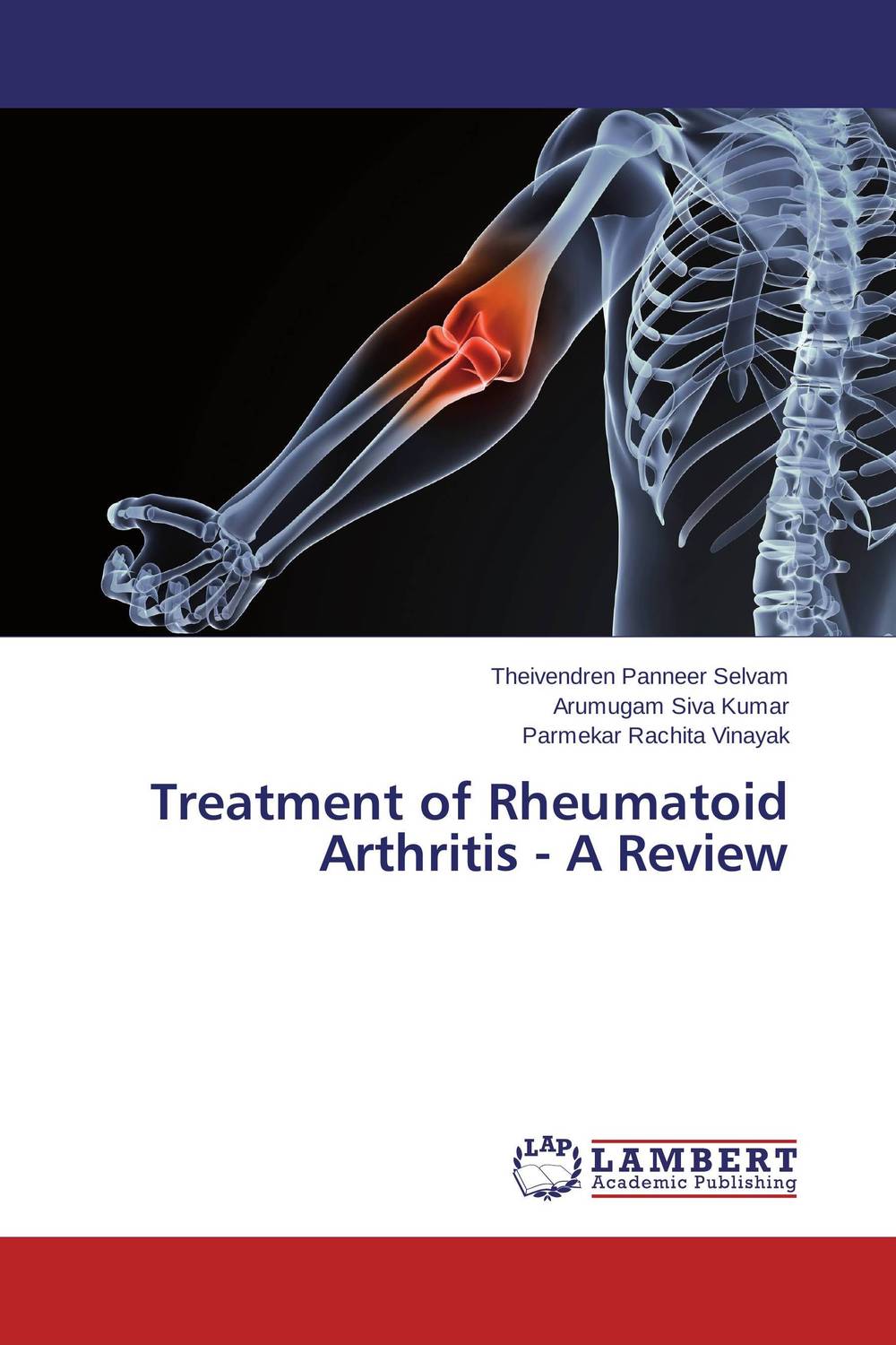 Treatment of Rheumatoid Arthritis - A Review