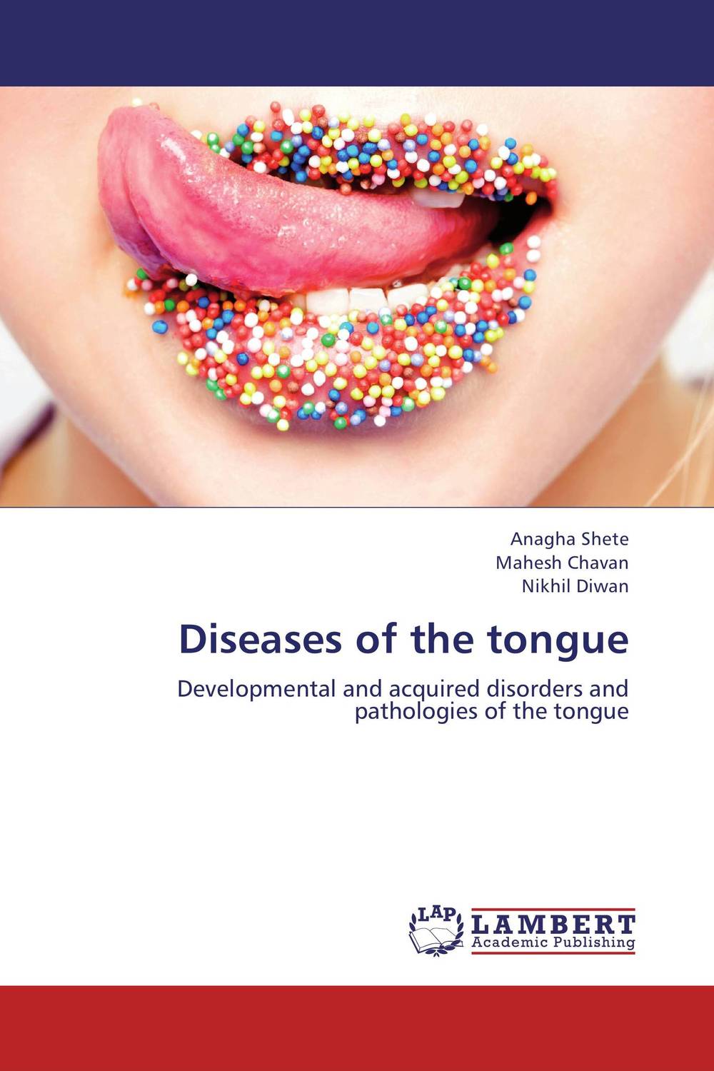 Diseases of the tongue12296407 Diseases of the tongue12296407The tongue is a very important organ in the oral cavity which performs multiple vital functions. It is important to understand the embryology, anatomy and physiology of the tongue in order to know various pathologic conditions affecting the tongue. This book entails the basic details of the tongue and gives us the plethora of the developmental, neurologic and acquired localized and generalized conditions of the tongue including cysts, benign and malignant tumors. It also tells about the lingual changes in systemic diseases. A special emphasis is also given on examination of the tongue, understanding special function of taste sensation and tongue mapping. Along with the text, this book also provides good quality clinical photographs which will help the readers understand the pathologies and formulate differential diagnoses.