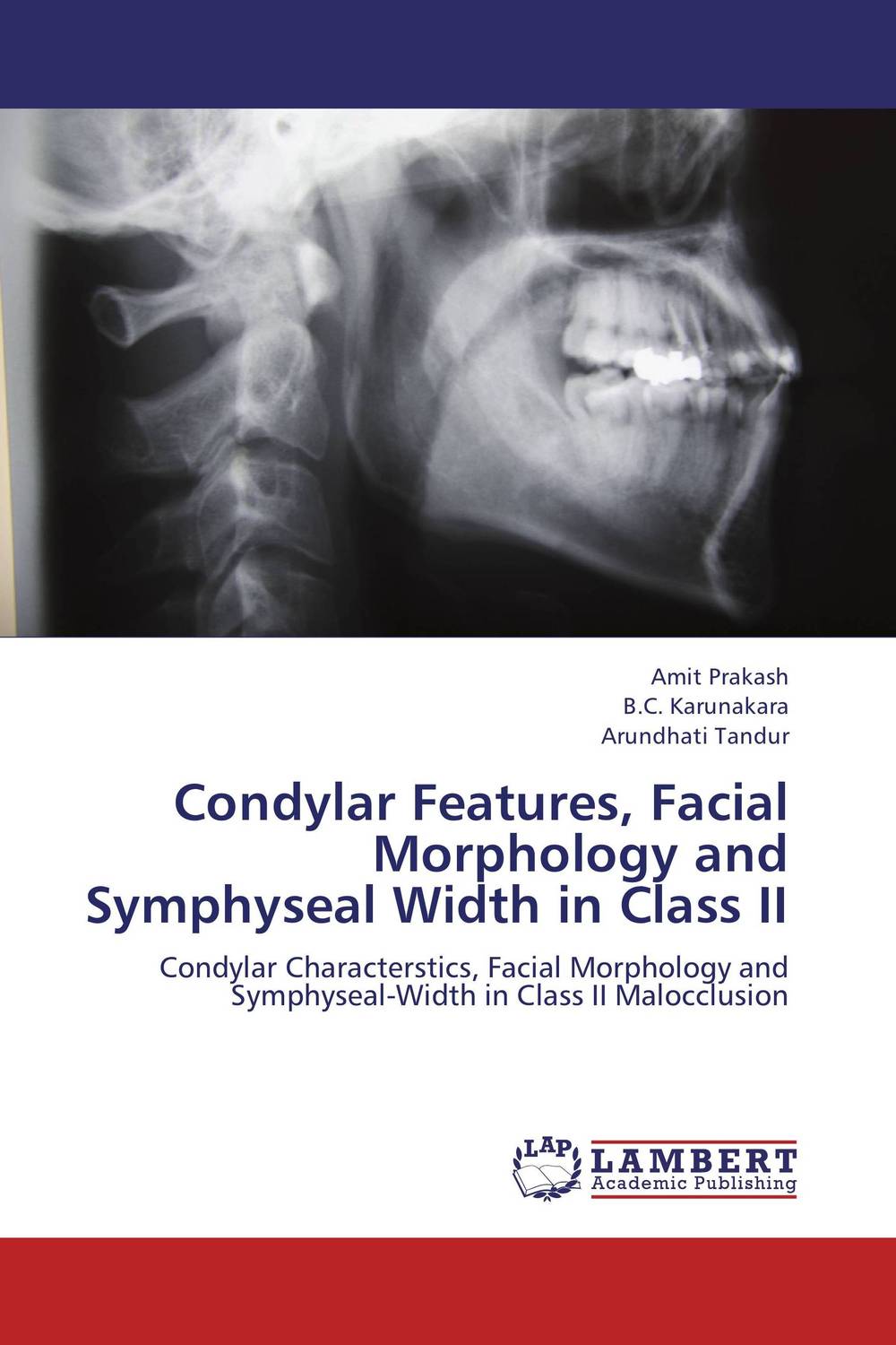 Condylar Features, Facial Morphology and Symphyseal Width in Class II