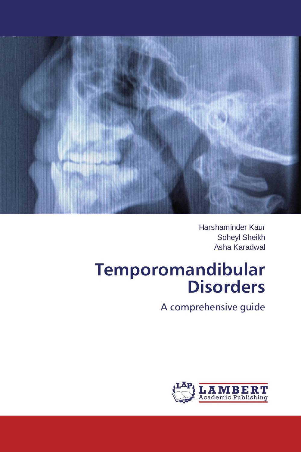 Temporomandibular Disorders