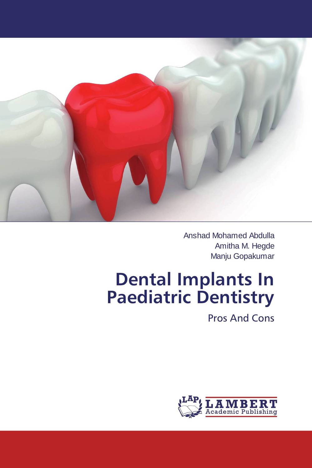 Dental Implants In Paediatric Dentistry