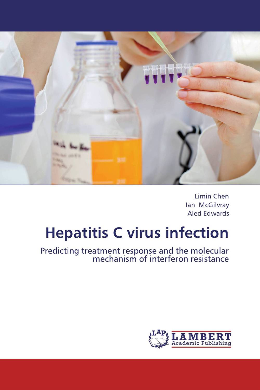 Hepatitis C virus infection