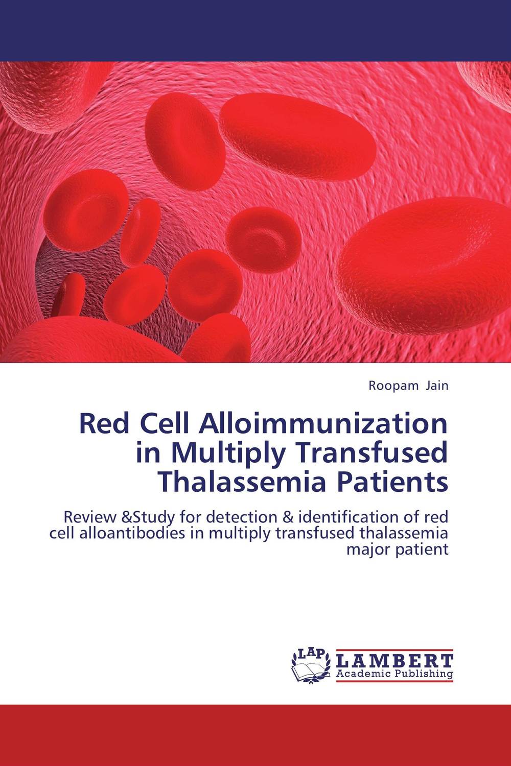 Red Cell Alloimmunization in Multiply Transfused Thalassemia Patients