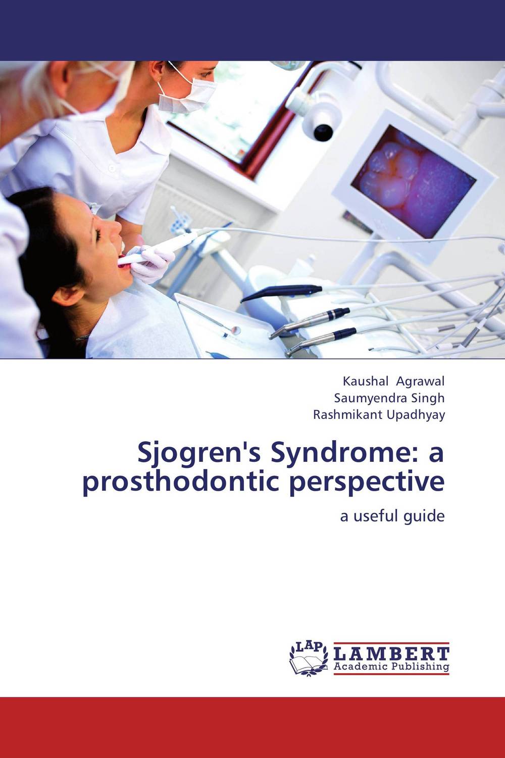 Sjogren`s Syndrome: a prosthodontic perspective