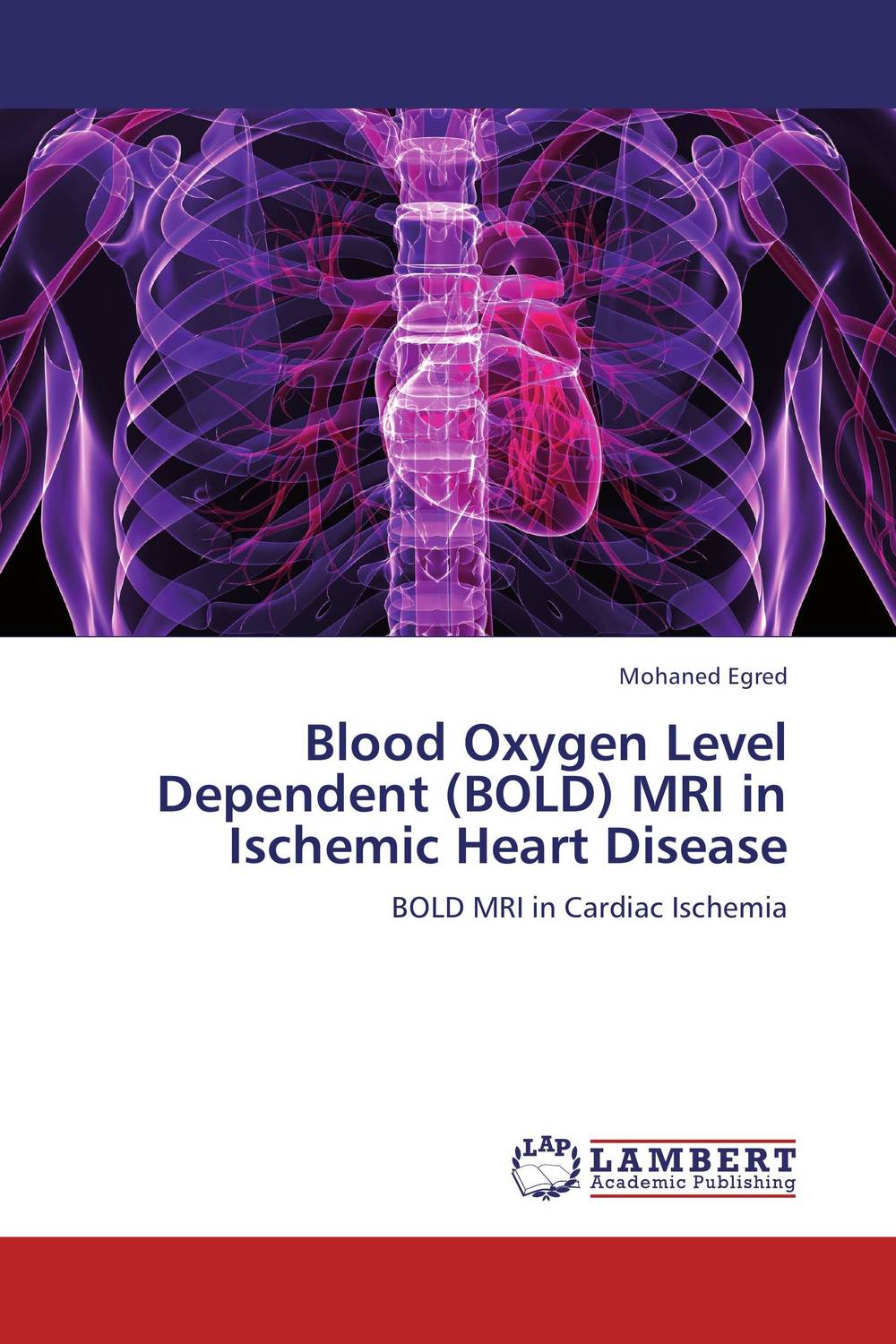 Blood Oxygen Level Dependent (BOLD) MRI in Ischemic Heart Disease