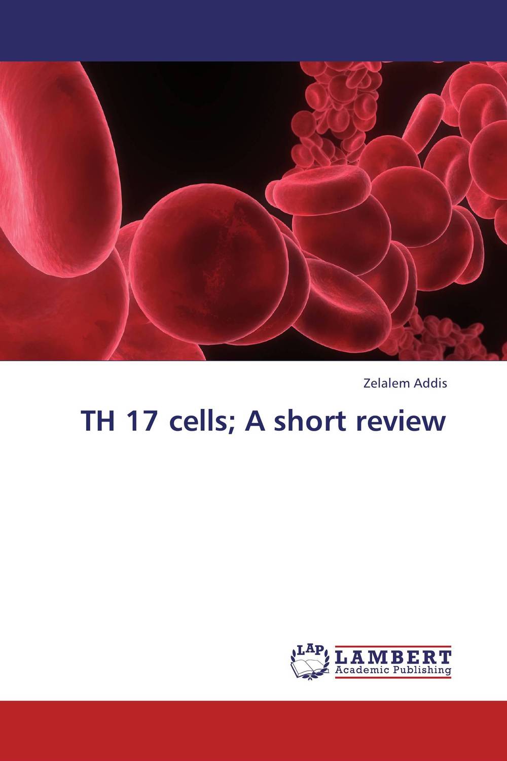 TH 17 cells; A short review12296407 TH 17 cells; A short review12296407TH 17 cells are recently recognized group T cells that have roles in clearance of microorganisms and induction of autoimmune diseases. These cells have distinct pathway of differentiation unlike to that of TH 1 and TH 2 cells.Different researches indicated the drivers and inhibitors involved in the differentiation of these novel cells.The effector function of interleukin 17 (IL-17), produced by these cells, has also been investigated. This short review provides an insight to TH 17 cells by compiling the outputs of different researches about the cell.