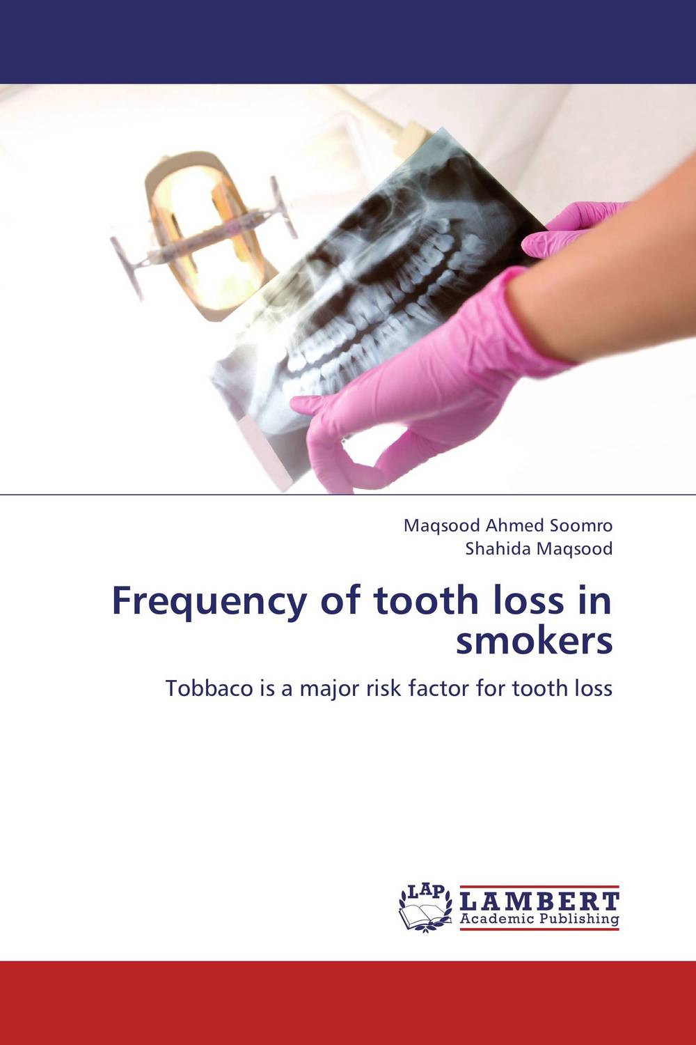 Frequency of tooth loss in smokers